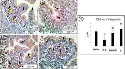 Potential role for vitamin D vs. intermittent fasting in controlling aquaporin-1 and aquaporin-3 expression in HFD-induced urinary bladder alterations in rats
